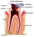 Root Canal & Endodontic Training in Thane Mumbai | Integrated